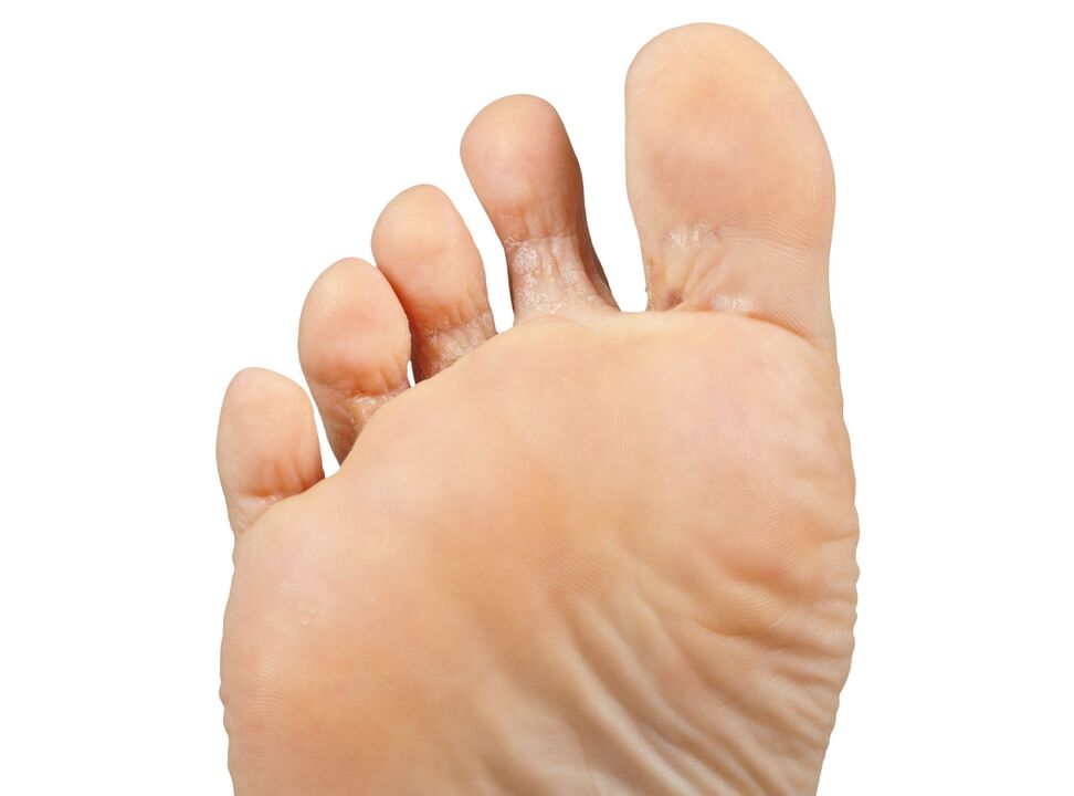 Fungerja-dobro-pair-in-hectic-Cream-Demyxil